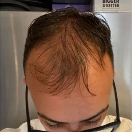 Customer hair before using Amazing Hair Saviour